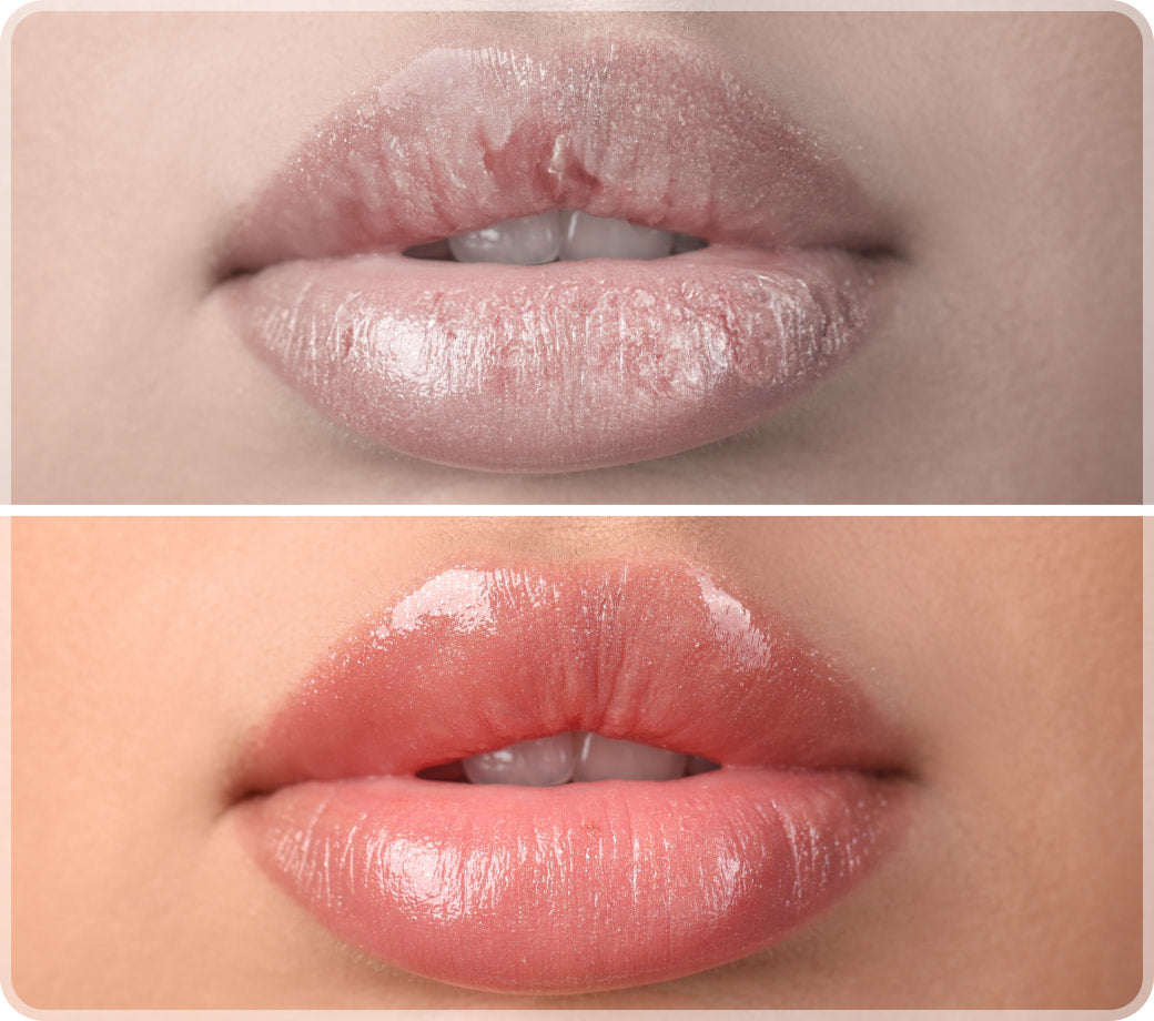 The Overnight Lip Treatment You Didn’t Know Existed
