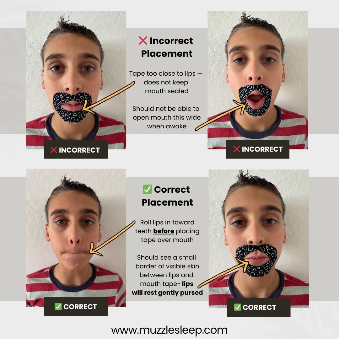 Muzzle® Mouth Tape For Kids (Medium Hold)