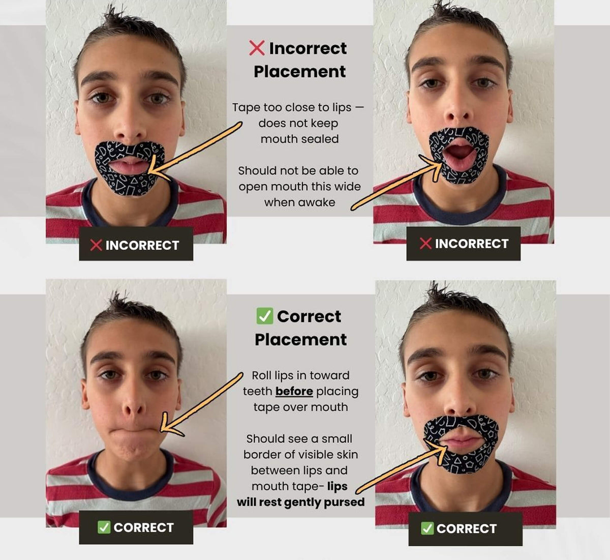 The first few nights may not be perfect — that’s okay and expected. Consistency improves sleep quality, which reduces restlessness over time. Once the child adjusts, most families report better sleep, easier mornings, and increased willingness to continue taping.