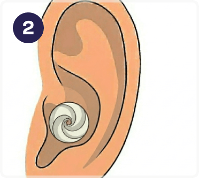 Step 2