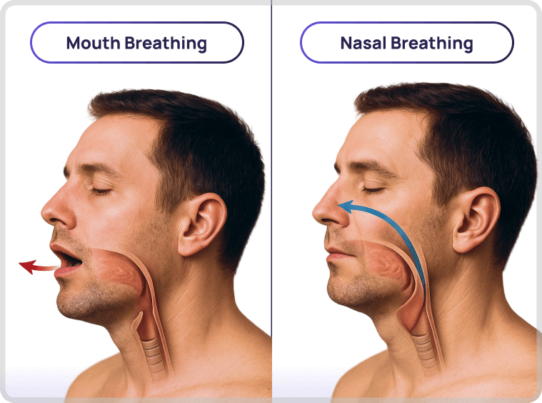 Snore Elimination